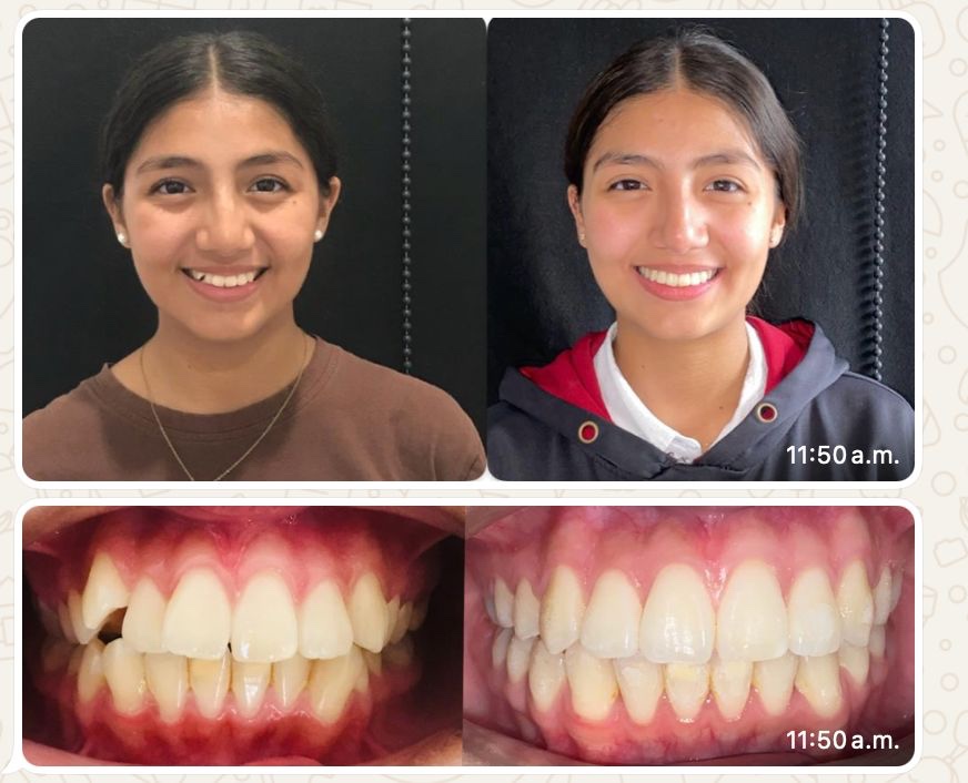 Resultado visual odontológico